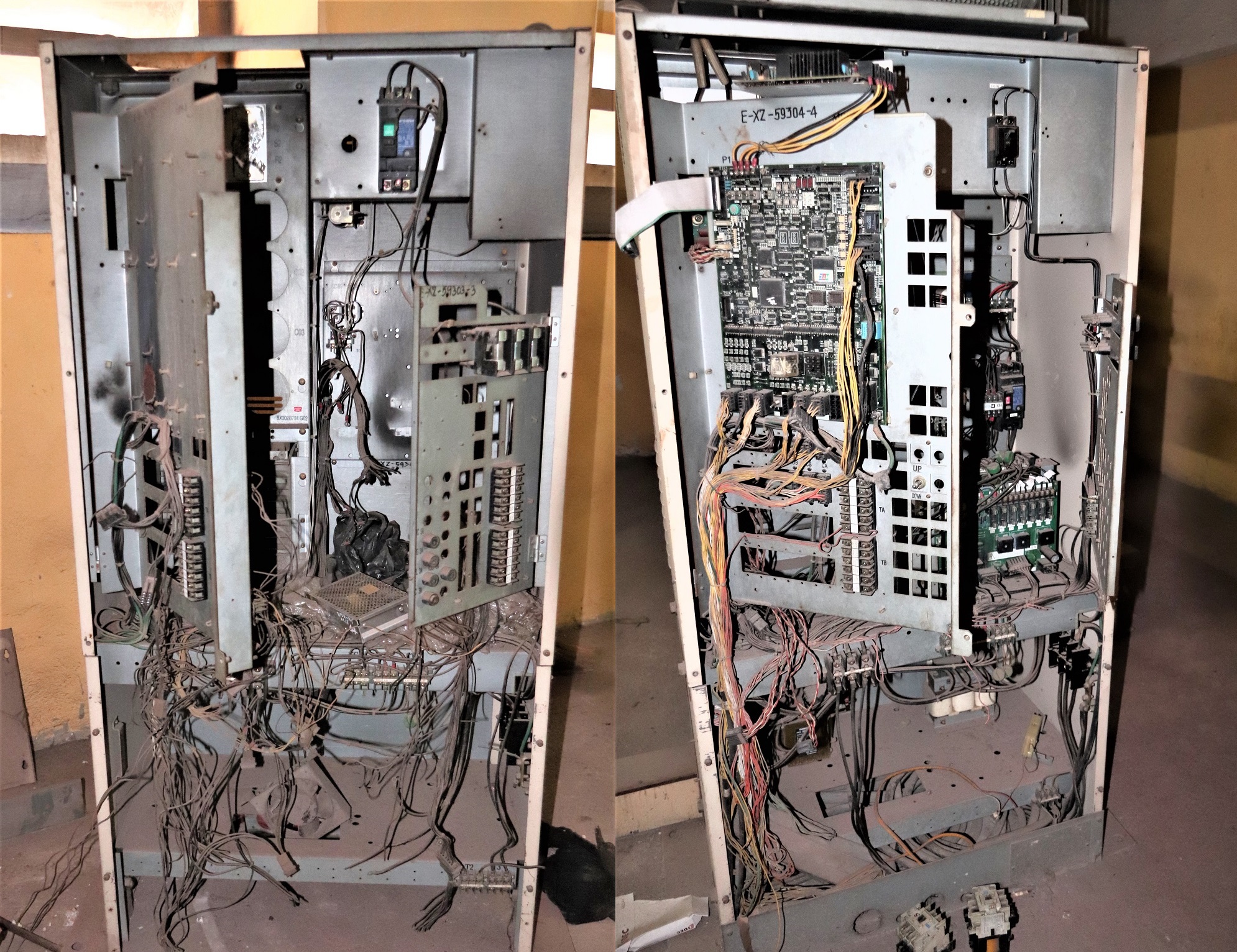 Răng sâu nhưng chữa không được mà nhổ không xong2