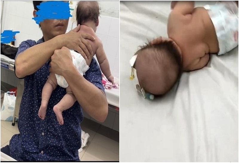 Hình ảnh ông Nguyễn Quốc Thắng – người giả danh bác sĩ Bệnh viện Nhi đồng 2 tập vật lý trị liệu cho bé 9 tháng tuổi (Ảnh: Tiền Phong, Dân Việt)