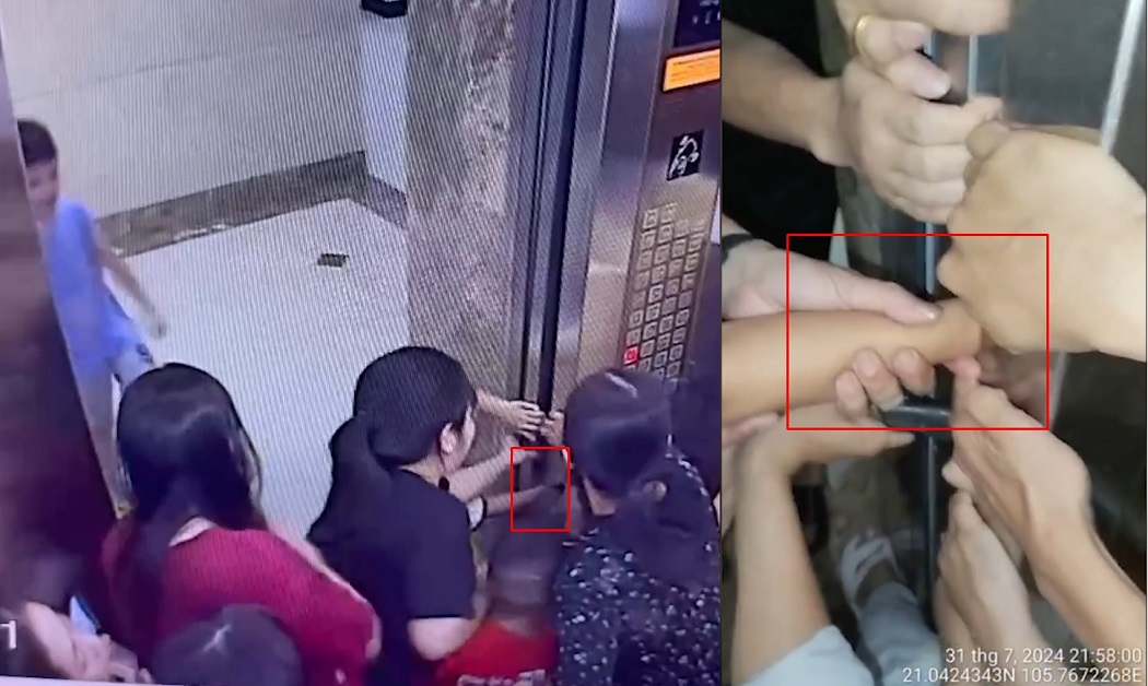 Phần cánh tay của cậu bé bị kẹt sâu trong khe hở giữa cửa thang máy và vách cabin